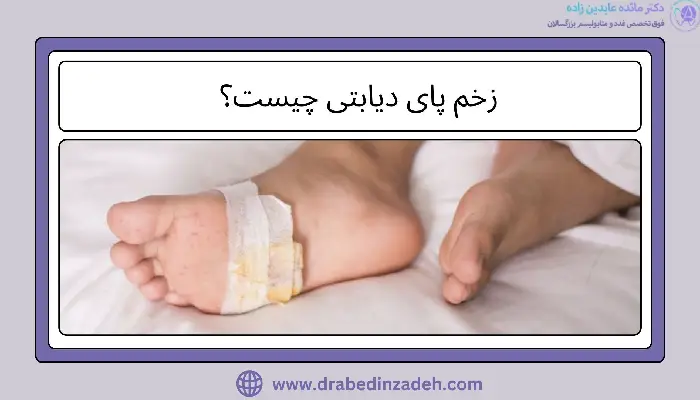زخم پای دیابتی