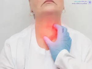 تیروئید پرکار