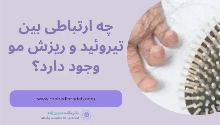 تیروئید و ریزش مو