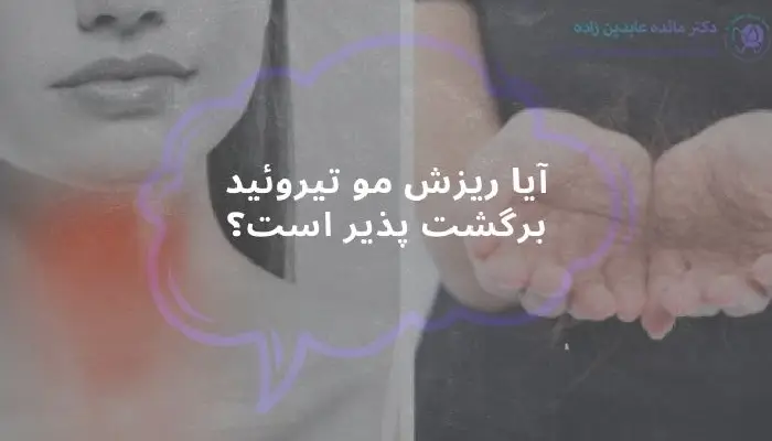تیروئید و ریزش مو