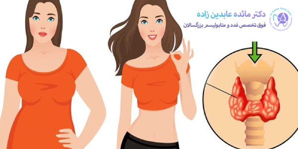 رابطه تیروئید با چاقی و لاغری