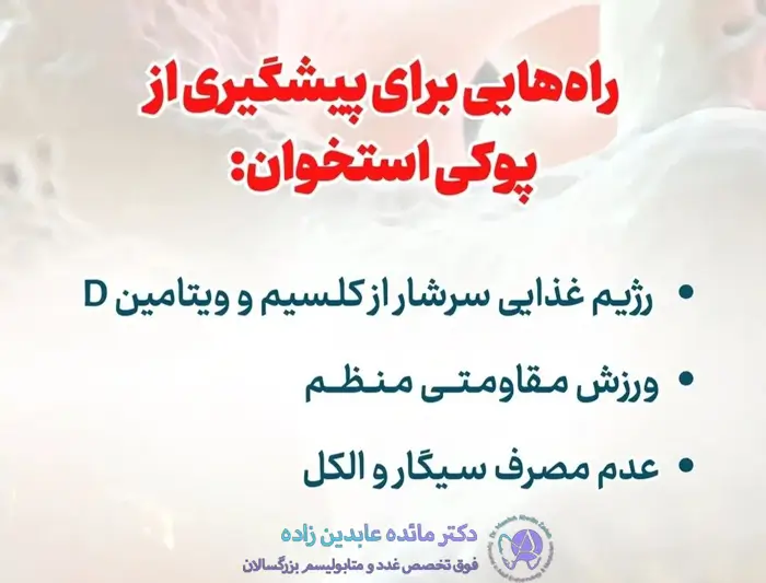 راه هایی برای پیشگیری از پوکی استخوان