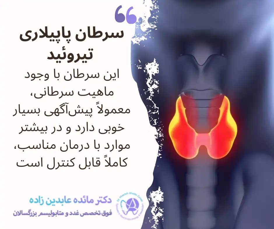 سرطان پاپیلاری تیروئید چیست؟