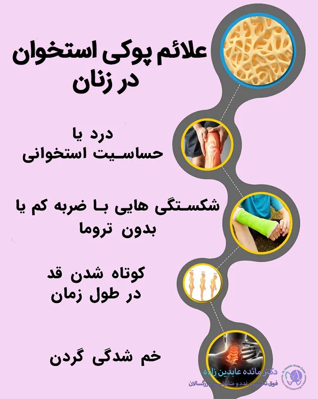 علائم پوکی استخوان در زنان