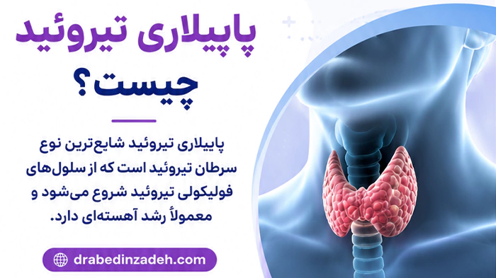 پاپیلاری تیروئید