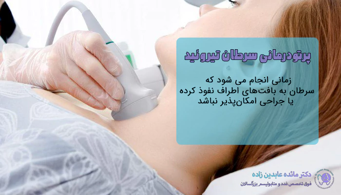 پرتودرمانی سرطان تیروئید