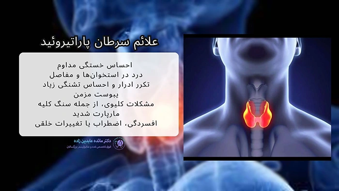علائم سرطان پاراتیروئید