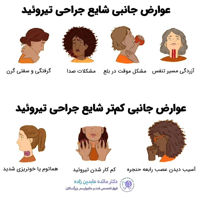 عوارض جانبی جراحی تیروئید