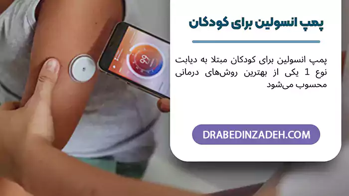 پمپ انسولین برای کودک