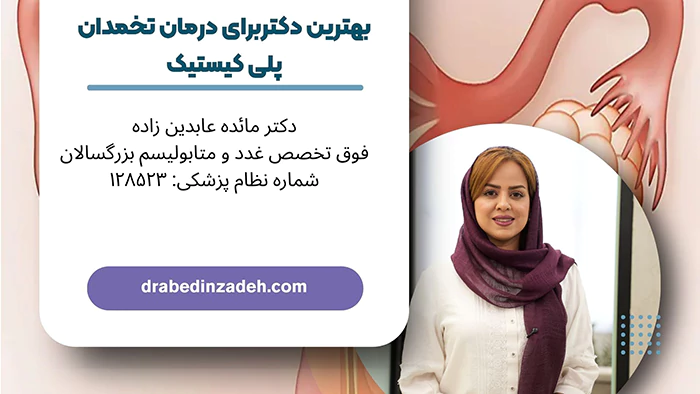 بهترین دکتربرای درمان تخمدان پلی کیستیک