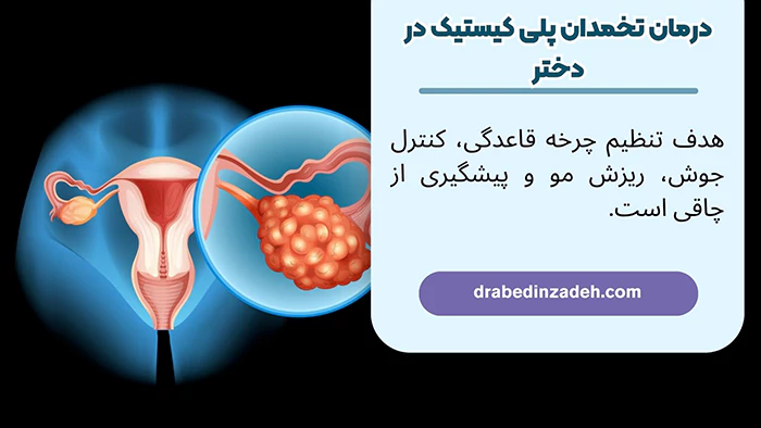 درمان تخمدان پلی کیستیک در دختر
