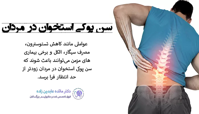 سن پوکی استخوان در مردان
