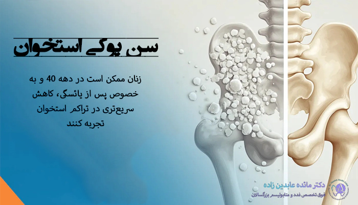 سن پوکی استخوان چقدره