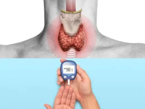 تاثیر دیابت و تیروئید