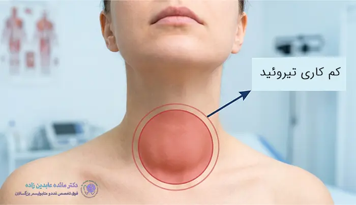 کمکاری تیروئید در زنان