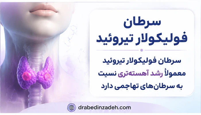 سرطان فولیکولار تیروئید