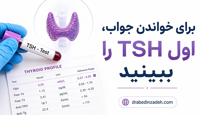 برای خواندن جواب آزمایش تیروئید ابتدا TSH را بررسی کنید